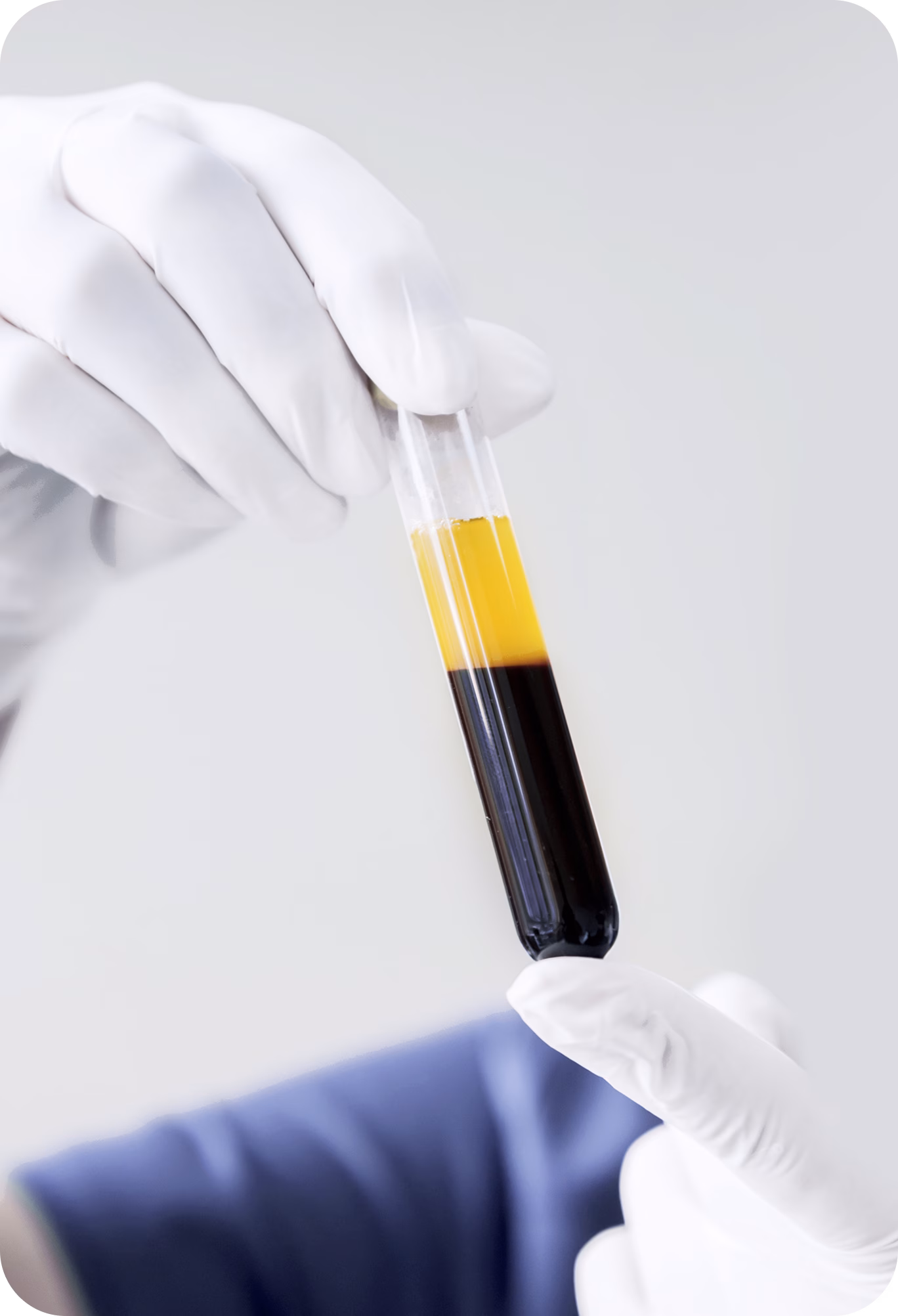 PRP 7 Rectangle 456 1 Miskawaan Health Group