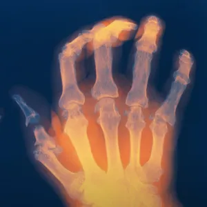 Rectangle 421 Miskawaan Health Group