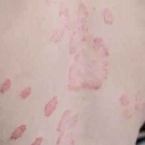 Rectangle 424 Miskawaan Health Group