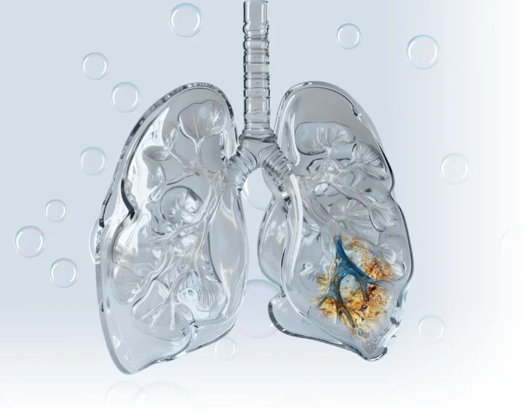 lung Miskawaan Health Group